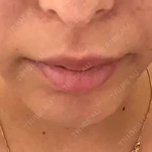 ライク整形外科口コミ