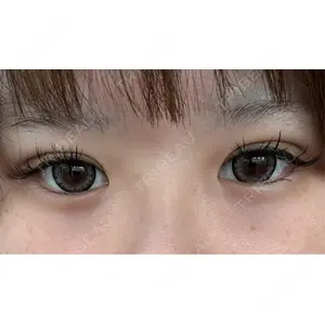 HAAB CLINIC HAAB BEAUTY CLINIC 名古屋院口コミ