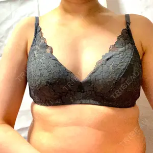 Lipo Clinic omotesando口コミ