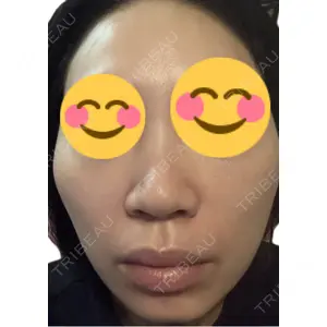 エルムクリニック 美容皮膚科エルムクリニック 麻布院口コミ