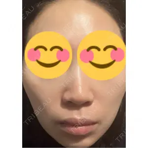 エルムクリニック 美容皮膚科エルムクリニック 麻布院口コミ