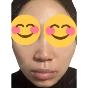 エルムクリニック 美容皮膚科エルムクリニック 麻布院口コミ