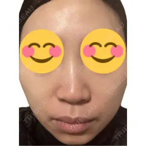 エルムクリニック 美容皮膚科エルムクリニック 麻布院口コミ