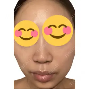 エルムクリニック 美容皮膚科エルムクリニック 麻布院口コミ