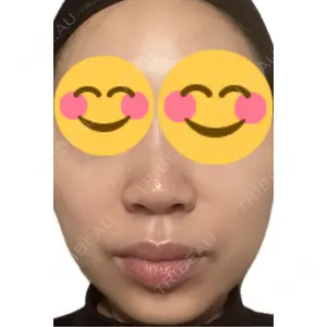 エルムクリニック 美容皮膚科エルムクリニック 麻布院口コミ