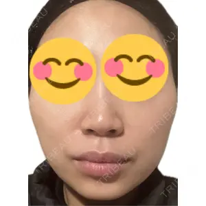 エルムクリニック 美容皮膚科エルムクリニック 麻布院口コミ