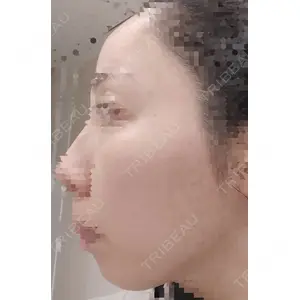 AZ BEAUTY CLINIC口コミ