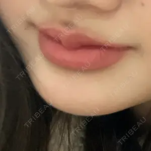 AZ BEAUTY CLINIC口コミ
