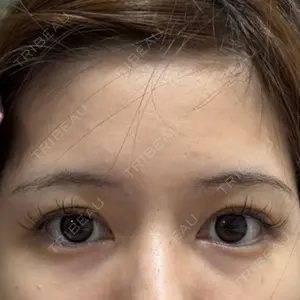 ビラビューティークリニック 博多美容外科/美容皮膚科 ビラビューティークリニック口コミ