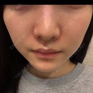 Belle Via Skin Clinic Belle Via Clinic口コミ