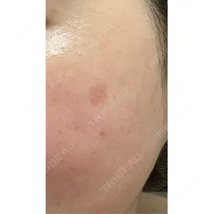 ルラ美容クリニック ルラ美容クリニック 郡山院口コミ