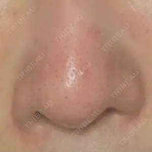 表参道メディカルクリニック 表参道メディカルクリニック 銀座院口コミ