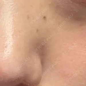 心斎橋KT美容クリニック口コミ