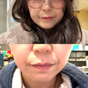 おおたかの森ビューティークリニック おおたかの森ビューティークリニック口コミ