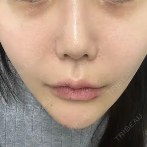 TCB東京中央美容外科 TCB東京中央美容外科 名古屋栄院口コミ