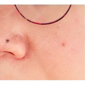 Fellez Clinic【フェルズクリニック】口コミ