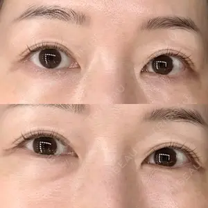 セオリークリニック口コミ