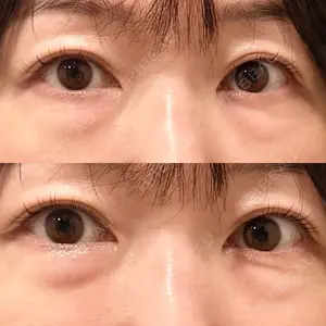 セオリークリニック口コミ
