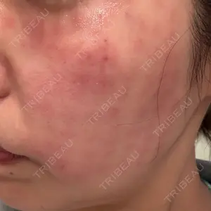 Belle Via Skin Clinic口コミ