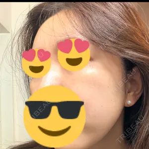 やさしい美容皮膚科・皮フ科 やさしい美容皮膚科・皮フ科　秋葉原院口コミ