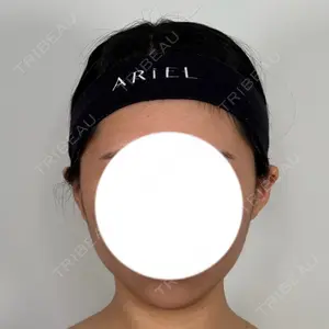 アリエル美容クリニック アリエル美容クリニック 水戸院口コミ