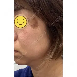 APスキンクリニック銀座口コミ