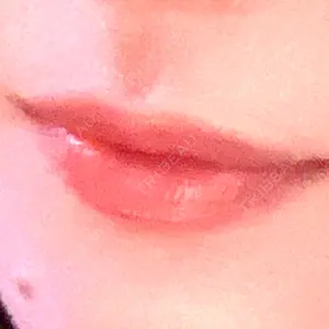 ルラ美容クリニック ルラ美容クリニック 大阪本院口コミ