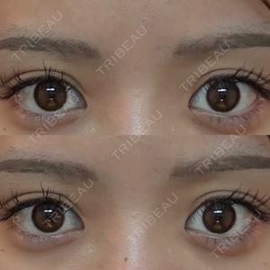 BITO BEAUTY CLINIC BITO BEAUTY CLINIC口コミ