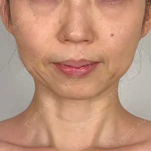 アリエル美容クリニック アリエル美容クリニック 水戸院口コミ