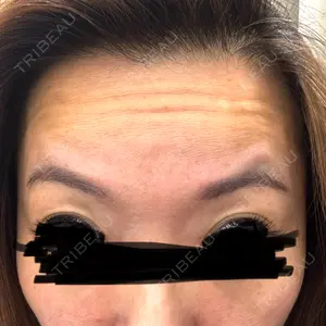 TCB東京中央美容外科 TCB東京中央美容外科 水戸院口コミ