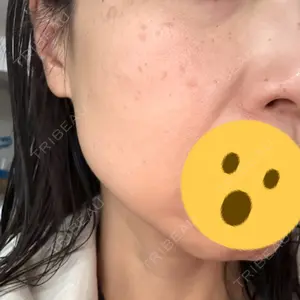 さっぽろ美容クリニック口コミ