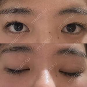 LUHO（ルホ）美容外科口コミ