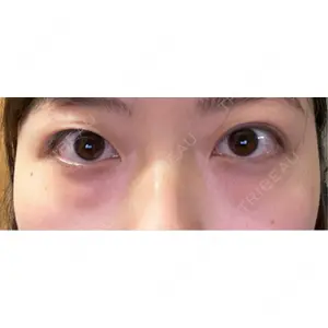 韓国ST美容整形外科口コミ