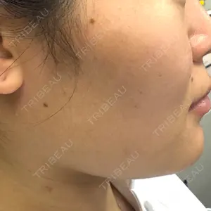 GRACY TOKYO CLINIC【グレイシートウキョウクリニック】口コミ