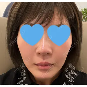 口コミ