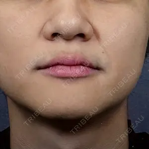 アイネクリニック アイネクリニック　川崎院口コミ