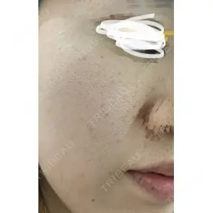 ビラビューティークリニック 博多美容外科/美容皮膚科 ビラビューティークリニック口コミ