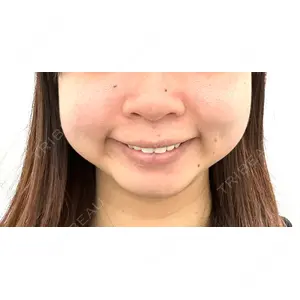 TCB東京中央美容外科 TCB東京中央美容外科 名古屋栄院口コミ