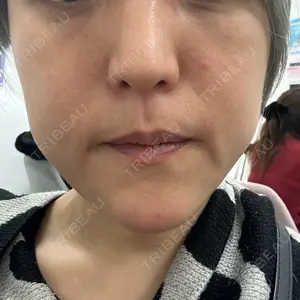 ルラ美容クリニック ルラ美容クリニック 大阪本院口コミ