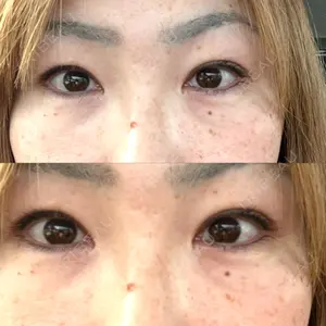 NARU Beauty Clinic NARU Beauty Clinic 【ナルクリ】 水戸院口コミ