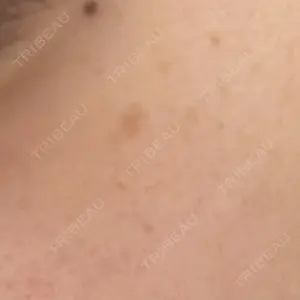 ルラ美容クリニック ルラ美容クリニック 名古屋本院口コミ