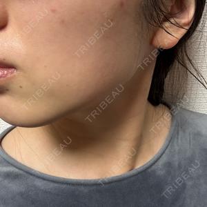 TCB東京中央美容外科 TCB東京中央美容外科 中野院口コミ