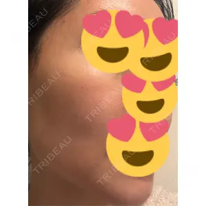 東京シルククリニック 東京シルククリニック 新宿院口コミ