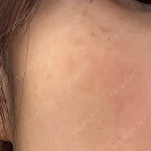 ルラ美容クリニック ルラ美容クリニック 広島院口コミ