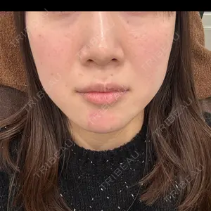 APスキンクリニック銀座口コミ
