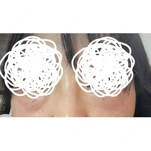 新宿Ladies&Gentlemen美容クリニック口コミ