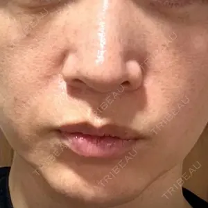 ルラ美容クリニック ルラ美容クリニック 名古屋本院口コミ