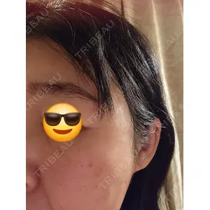 アイビークリニック 千葉美容外科アイビークリニック口コミ