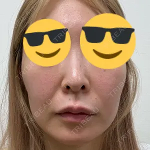 東京シルククリニック 東京シルククリニック 新宿院口コミ