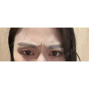 Belle Via Skin Clinic Belle Via Clinic口コミ